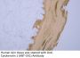 Cytokeratin 1 (ABT-CK1) Antibody