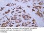 Cytokeratin 13 (ABT-CK13) Antibody