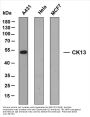 Cytokeratin 13 (ABT-CK13) Antibody
