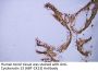 Cytokeratin 13 (ABT-CK13) Antibody