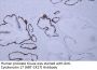 Cytokeratin 17 (ABT-CK17) Antibody
