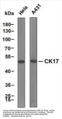 Cytokeratin 17 (ABT-CK17) Antibody