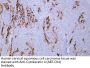 Cytokeratin 4 (ABT-CK4) Antibody