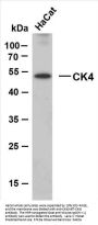 Cytokeratin 4 (ABT-CK4) Antibody