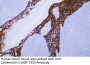 Cytokeratin 5 (ABT-CK5) Antibody