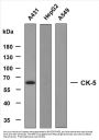 Cytokeratin 5 (ABT-CK5) Antibody