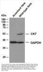 Cytokeratin 7 (ABT-CK7) Antibody