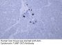 Cytokeratin 7 (ABT-CK7) Antibody