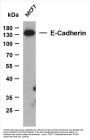 E-Cadherin (ABT270) Antibody