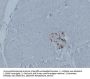 Glucagon (ABT-GCG) Antibody