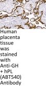GH/ hPL (ABT540) Antibody