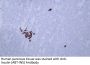 Insulin (ABT-INS) Antibody