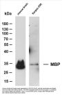 Myelin Basic Protein(MBP) (ABT-MBP) Antibody