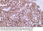 Parathyroid Hormone (PTH) (ABT-PTH) Antibody