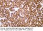 Parathyroid Hormone (PTH) (ABT-PTH) Antibody