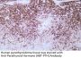 Parathyroid Hormone (PTH) (ABT-PTH) Antibody