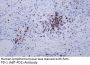 PD-1 (ABT-PD1) Antibody