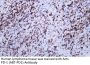 PD-1 (ABT-PD1) Antibody