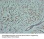 Progesterone Receptor(PR) (ABT-PR) Antibody
