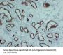Progesterone Receptor(PR) (ABT-PR) Antibody