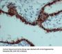 Progesterone Receptor(PR) (ABT-PR) Antibody