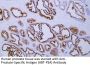 PSA (ABT-PSA) Antibody