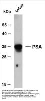 PSA (ABT-PSA) Antibody