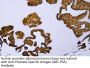 PSA (ABT-PSA) Antibody