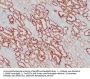 pVHL (ABT-PVHL) Antibody