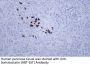 Somatostatin (ABT-SST) Antibody