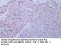 Wilms' Tumor 1(WT1) (ABT-WT1) Antibody