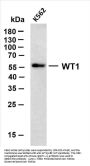 Wilms' Tumor 1(WT1) (ABT-WT1) Antibody