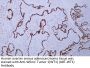 Wilms' Tumor 1(WT1) (ABT-WT1) Antibody