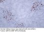 Wilms' Tumor 1(WT1) (ABT-WT1) Antibody