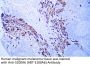 S100A6 (ABT-S100A6) Antibody