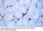 S100A6 (ABT-S100A6) Antibody
