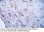 S100A6 (ABT-S100A6) Antibody