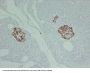 TIMP1 (ABT-TIMP1) Antibody