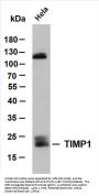 TIMP1 (ABT-TIMP1) Antibody