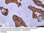 Anti-Human Cytokeratin 16 (ABT059) Mouse Monoclonal Antibody (Ready to Use)
