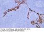 Anti-Human Cytokeratin 16 (ABT059) Mouse Monoclonal Antibody (Ready to Use)