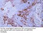 Anti-Human Cytokeratin 16 (ABT059) Mouse Monoclonal Antibody (Ready to Use)