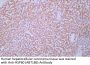 Anti-Human HSP60 (ABT186) Mouse Monoclonal Antibody (Ready to Use)