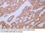 Anti-Human HSP60 (ABT186) Mouse Monoclonal Antibody (Ready to Use)