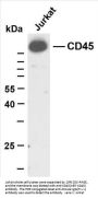 CD45 (ABT-CD45) Antibody