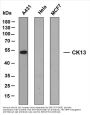 Cytokeratin 13 (ABT-CK13) Antibody