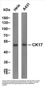 Cytokeratin 17 (ABT-CK17) Antibody