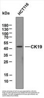 Cytokeratin 19&10 (ABT-CK19) Antibody