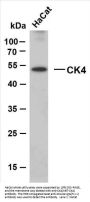 Cytokeratin 4 (ABT-CK4) Antibody