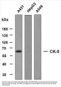 Cytokeratin 5 (ABT-CK5) Antibody